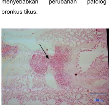 Gambar 4. Gambaran Histopatologi Bronkus TikusKelompok  P2  (Fokus  Limfoid  pada  satu  ekortikus)