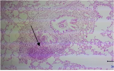 Gambar 2. Gambaran Histopatologi Bronkus TikusKelompok P1 (Sel Plasma). Gambar  tanda panah di atas menunjukkan sel plasma pada jaringan bronkus, potongan melintang dengan pulasan HE, perbesaran 400x.