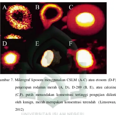 Gambar 7. Mikrograf liposom menggunakan CSLM (A-C) atau etosom (D-F) 