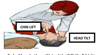 Gambar 2.4. Head tilt – Chin lift (ERC, 2010) 