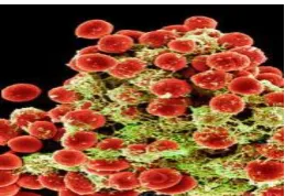 Gambar 2. Staphylococcus epidermidis (Anonima, 2000).