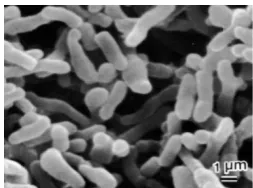 Gambar 3. Propionibacterium acnes (Anonimb, 2000) 