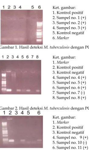 Gambar 3. Hasil deteksi M. tuberculosis dengan PCRKet. gambar:  1. Marker 2. Kontrol positif   3