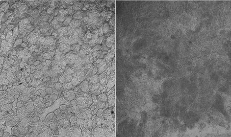 Gambar 1. Perbedaan gonad jantan (kanan) dan betina (kiri)  Penggunaan  17α-metiltestoteron 