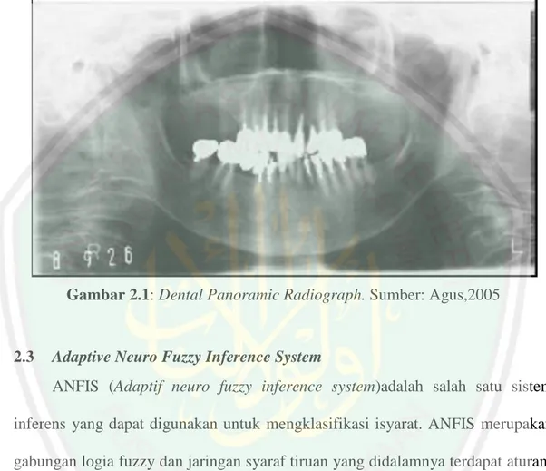 Gambar 2.1: Dental Panoramic Radiograph. Sumber: Agus,2005 