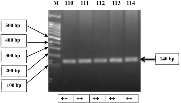 Gambar 8. Visualisasi hasil PCR-RFLP gen BMPR-1B pada gel agarose 2