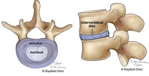 Gambar 2.3 Discus Intervertebralis 