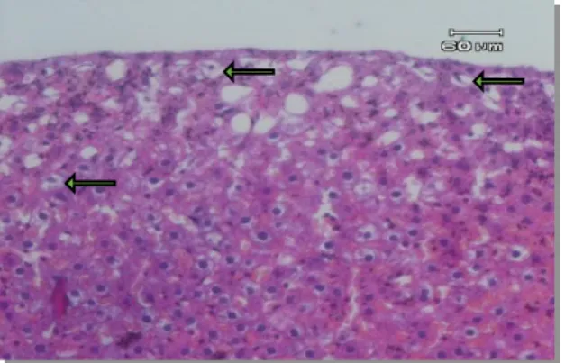 Gambar  2.2  Gambaran  mikroskopik  hati  tikus  wistar  kelompok  B  (pembesaran  10x40)