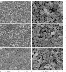 Gambar 2. Gambaran filler pada masing-masing resin komposit. A dan B resin komposit  mikrofil, C dan D resin komposit nanofil, serta E dan F adalah resin komposit nanohybrid [23] 
