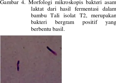 Gambar 4. Morfologi mikroskopis bakteri asam 