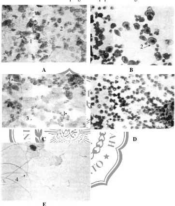 Gambar 1. Ampus vagina tikus: A. Fase estrus, banyak sel tanduk; B. Fase proestrus, banyak sel berinti (ovum); C