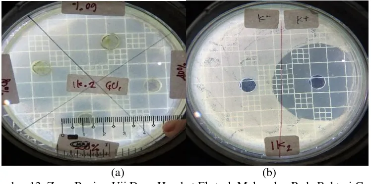 Gambar 12. Zona Bening Uji Daya Hambat Ekstrak Makroalga Pada Bakteri Gram 