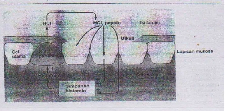 Gambar 2.3 Pembentukan ulkus. 