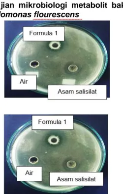 Gambar  3.  Hasil  analisis  mikrobiologi  difusi  perforasi  terhadap  Staphylococcus  aureus  setelah fermentasi 28 jam