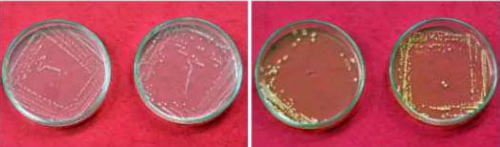 Gambar 1. Koloni bakteri endofit asal perakaran jagung dari kelompok Bacillus sp. (a) dan Pseudomonas sp