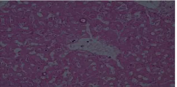 Gambar 3. Gambaran histopatologi hepar mencit pada kelompok Perlakuan 2 dengan perbesaran 400x