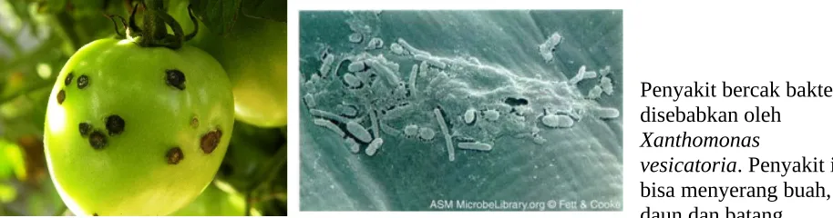gambar 20. Xanthomonas Sp.