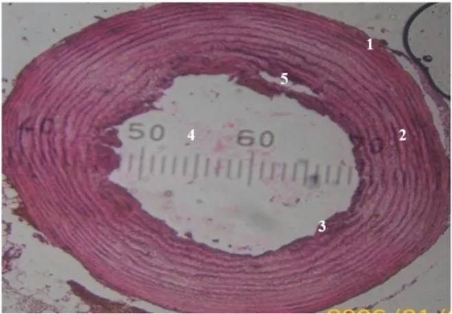 Gambar 8.   Pembuluh  aorta  hewan  yang  diinduksi dengan koktail aterogenik dan diberi  dosis fraksi etil asetat daun surian 200 mg/
