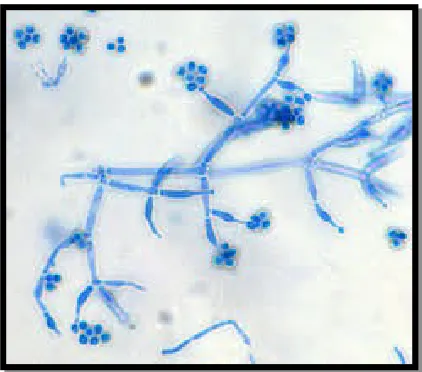 Gambar 5.Bentuk Mikroskopis Tricoderma sp.