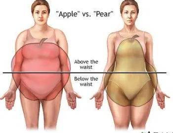 Gambar 1. Bentuk Tubuh  Apple dan Pear (Tsai, 2007) 