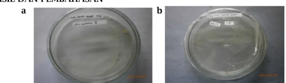 Gambar 2. a. Uji bakteri tanah terhadap Ph, b. Uji bakteri tanah terhadap suhu 45 o C, 10 o C, dan  30 o C