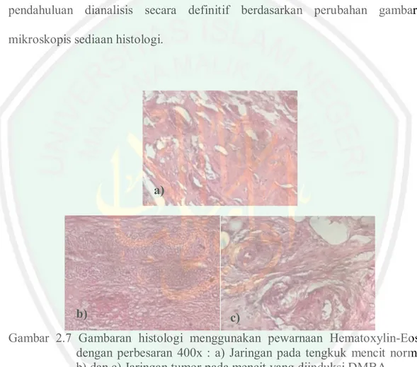 Gambar 2.7 Gambaran histologi menggunakan pewarnaan Hematoxylin-Eosin dengan perbesaran 400x : a) Jaringan pada tengkuk mencit normal, b) dan c) Jaringan tumor pada mencit yang diinduksi DMBA.