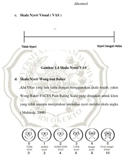 Gambar 1.4 Skala Nyeri VAS 