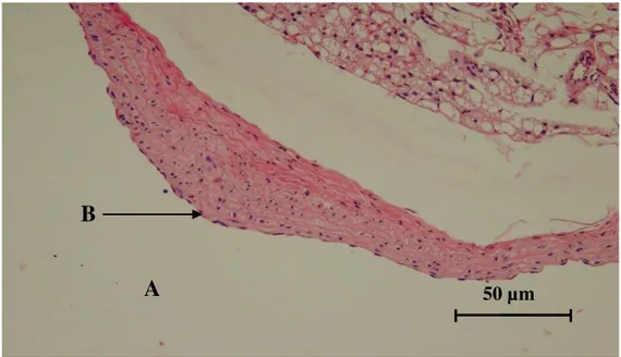 Gambar 5.  Gambaran histopatologis aorta tikus putih yang diberi pakan lemak tinggi selama 90 hari,  kemudian setelah 1 bulan perlakuan, hewan tersebut juga diberi chitosan 180 mg/ kg BB/ 