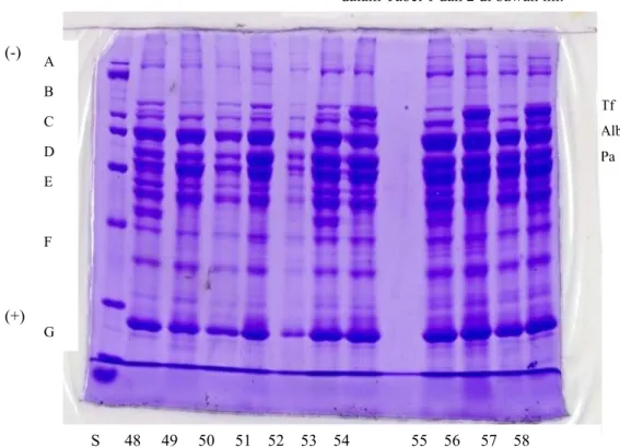 Gambar 1. Elektroforegram profil protein plasma darah ikan gurami. 