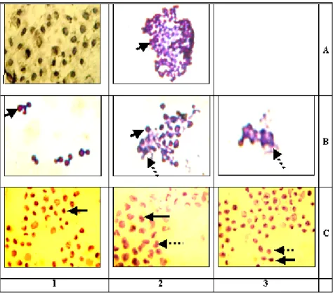 Tabel I.  Ekspresi VEGF pada sel T47D dengan  berbagai perlakuan, diamati dengan  metode immunositokimia dengan  meng-gunakan kromogen DAB 
