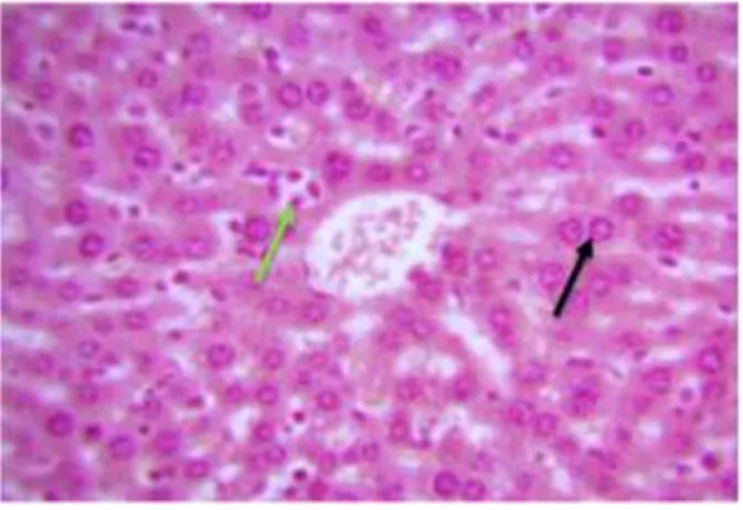 Gambar 1.   Struktur  Mikroanatomi  Hati  Mencit  Kelompok  Perlakuan  Akuabides  selama       20  hari  (Panah  Hitam:  Hepatosit  Normal; 