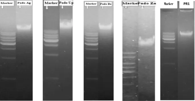 Gambar di atas menunjukkan bahwa keempat isolat bakteri  asam laktat asal ikan pado berhasil  dilakukan  ekstraksi  genom,  hal  ini  ditandai  dengan  terbentuknya  pita  DNA  yang  lebih  tinggi  dibandingkan marker setelah dilakukan pengamatan di bawah 