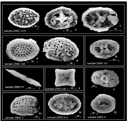 Fig. 4. SEM microphotographs of late Cretaceous species of CN found in rock clasts.