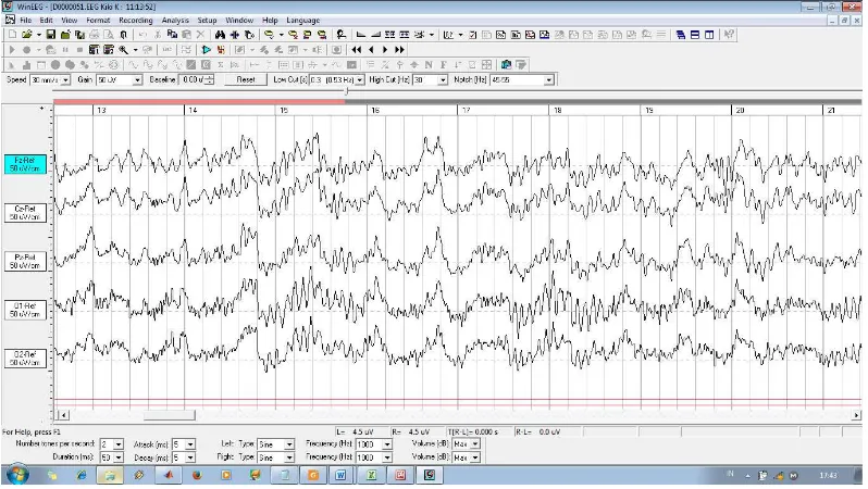 Gambar 3.8 Tampilan sinyal EEG pada WinEEG. 