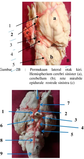 Gambar  2B  :  Permukaan  lateral  otak  kiri. 