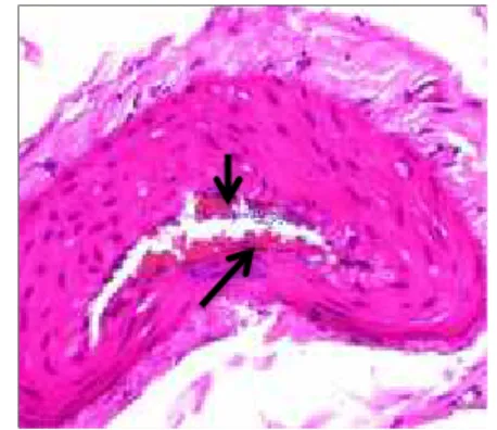 Gambar 1. Trombus (panah hitam) pada potongan lumen arteri melintang kelompok H10 di 0 cm dari