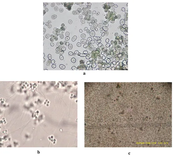 Gambar 3.  Tahap perkembangan gamet jantan (sperma) (a). Cluster spermatogonia (Perbesaran  10×10) (b) Tetrad sperma (Perbesaran 10×40) (c)