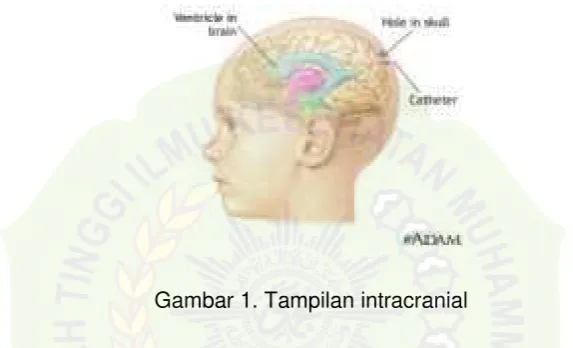Gambar 1. Tampilan intracranial