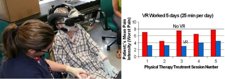 Fig. 3 Patient withcombat-related burn injuriesreceiving wound care inimmersive virtual reality viarobot-like arm mounted VRgoggles which do not requirewearing a head mounted VRhelmet