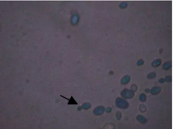 Gambar 1.  Saccharomyces sp. hasil pengamatan yang diwarnai dengan metilen blue. Tanda panah menunjuk tunas
