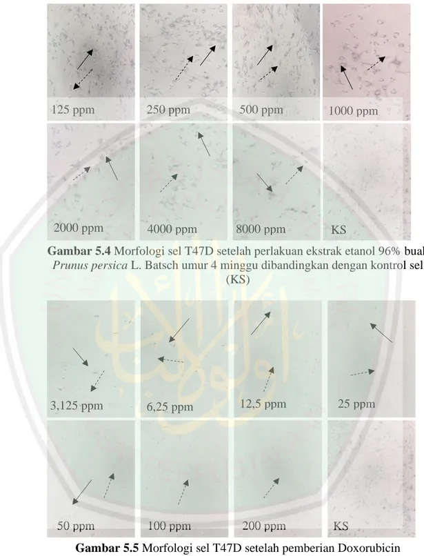 Gambar 5.4 Morfologi sel T47D setelah perlakuan ekstrak etanol 96% buah  Prunus persica L