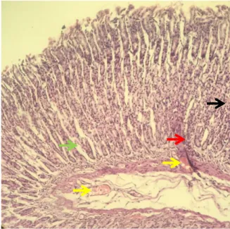Gambar  3.2.  Gambaran  mikroskopik  lambung  tikus wistar kelompok C. Tampak sel-sel radang,  vasodilatasi,  edema,  dan  sel-sel  regenerasi  (Panah  merah:  sel-sel  radang;  panah  kuning:  pembuluh  darah  yang  melebar;  panah  hijau:  edema;  panah 