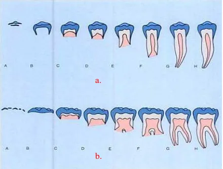 Gambar 2. Tahap kalsifikasi gigi tetap menurut Demirjian, dkk. berakar tunggal (a)                         dan berakar ganda (b)