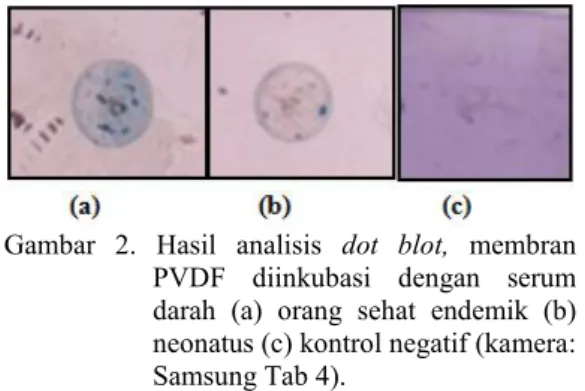 Gambar 2. Hasil  analisis dot  blot, membran PVDF  diinkubasi  dengan  serum darah  (a)  orang  sehat  endemik  (b) neonatus (c) kontrol negatif (kamera: