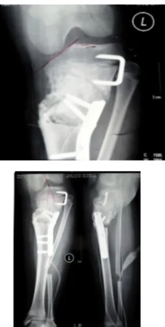 Gambar 3. Preoperatif Pasien 2 