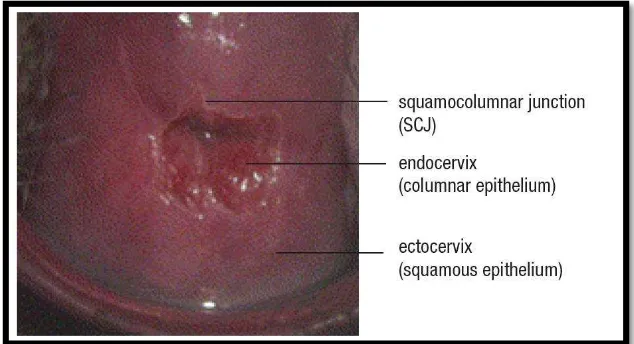 Gambar 2.3.  Dua tipe epitel pelapis serviks dan SCJ Dikutip dari Comprehensive Cervical Cancer Control, WHO