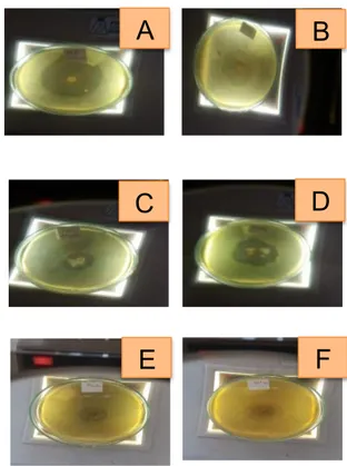 Gambar 1. Zona Hambat Bakteri (Tampak Atas)  S.enterica sv enteritdis (A,B), P. aeroginossa  (C,D), KP P
