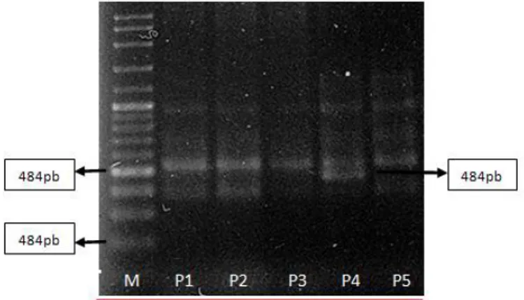 Gambar 1. Elektroforesis gen UTY pada lima pooled-DNA sapi Bali unknown sex sample.