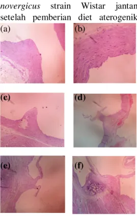 Gambar 4.1  memperlihatkan  gambaran histopatologi arteri koroner  Rattus novergicus strain Wistar jantan  