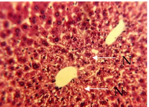 Gambar 4. Gambaran anatomi mikroskopik hati mencit  kelompok IV (kelompok mencit yang diberikan minyak  kelapa sawit yang telah dipanaskan 10 kali)